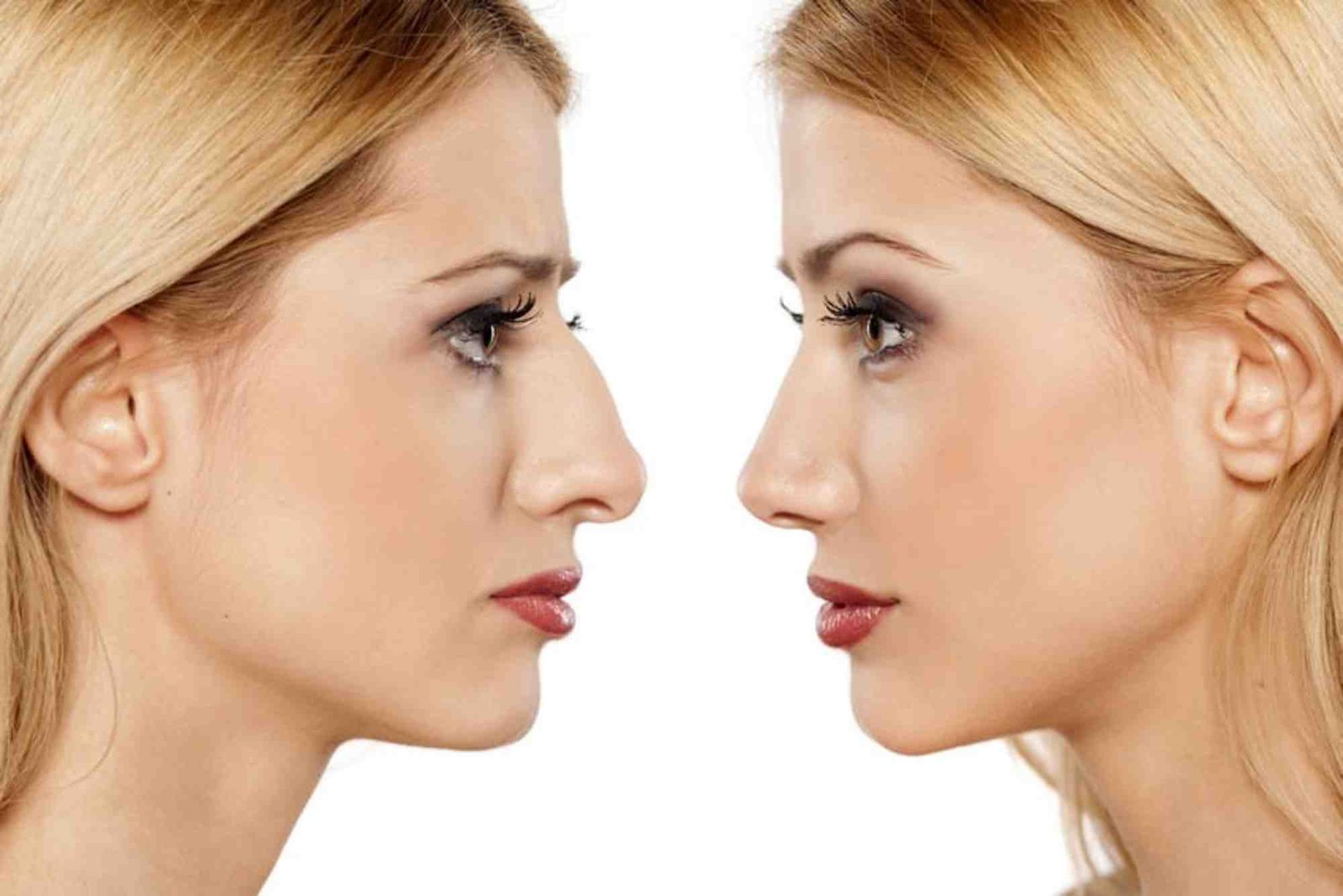 Is Rhinoplasty In Turkey Worth The Price